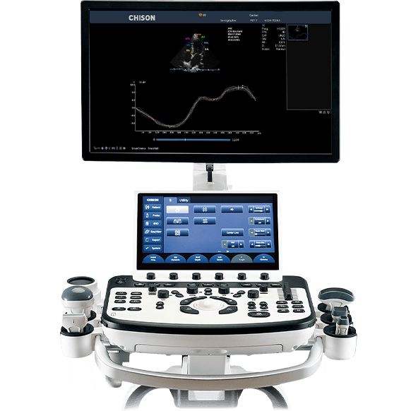 XBit 90 Ultrasound System