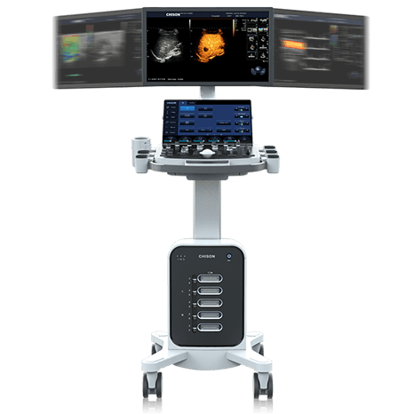 SonoMax 7 Ultrasound System
