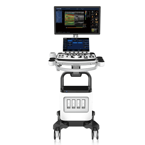 XBit 80 Ultrasound System