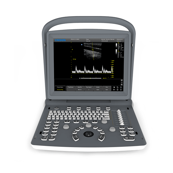ECO 2 Ultrasound System