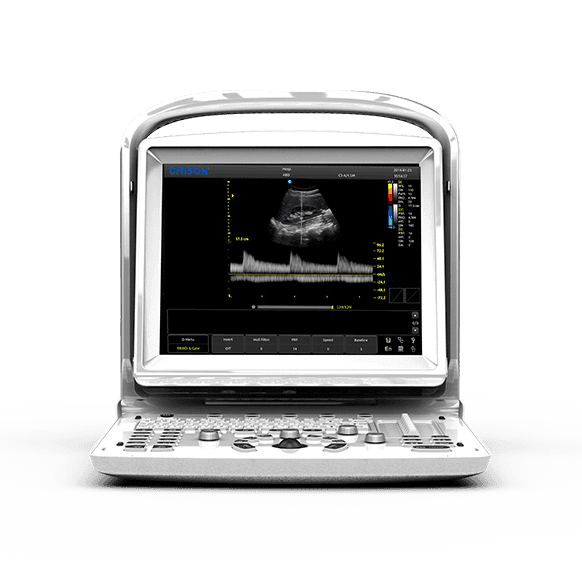 ECO 3 EXPERT Ultrasound System