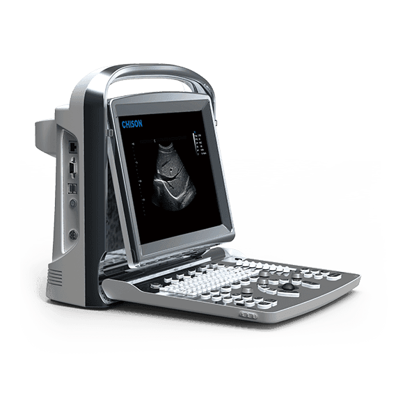 ECO 1 Ultrasound System
